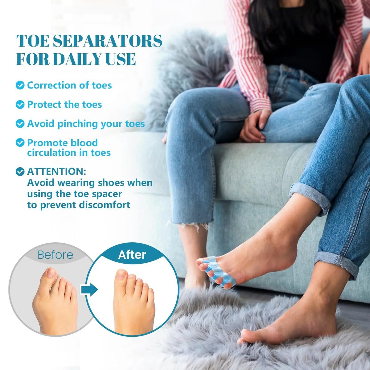 Align™ Toe Separators